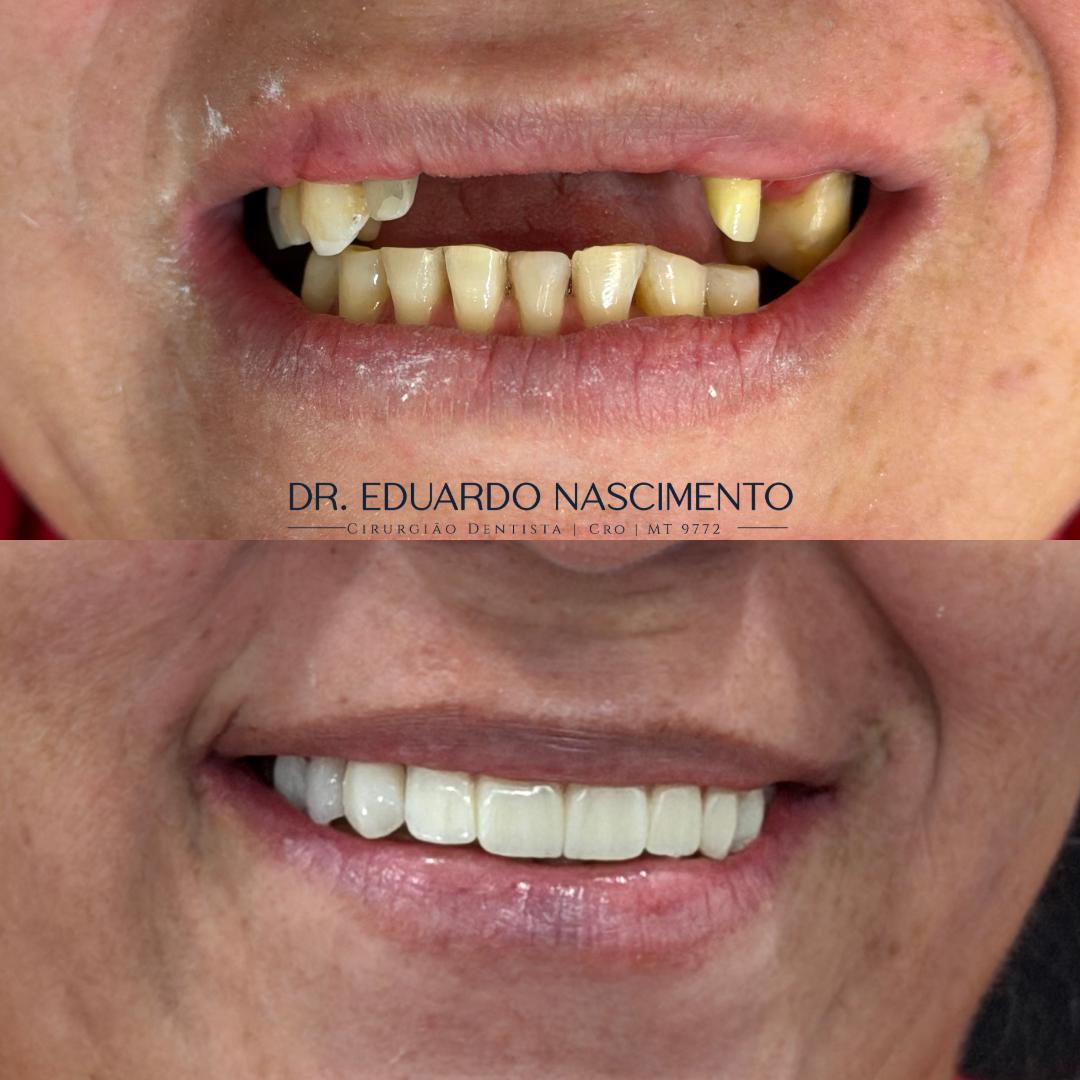 Antes e depois — caso real 2