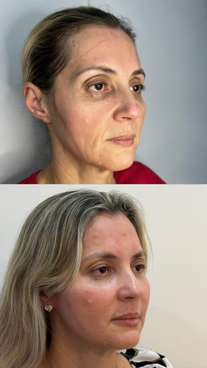 Antes e depois — caso real 6